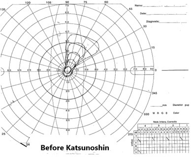 before katsunoshin