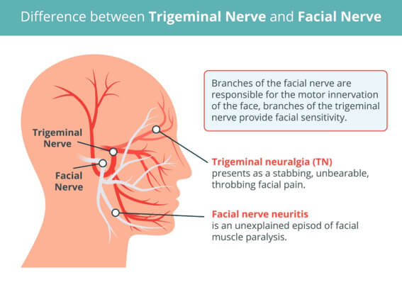 difference between trigeminal nerve and facial nerve